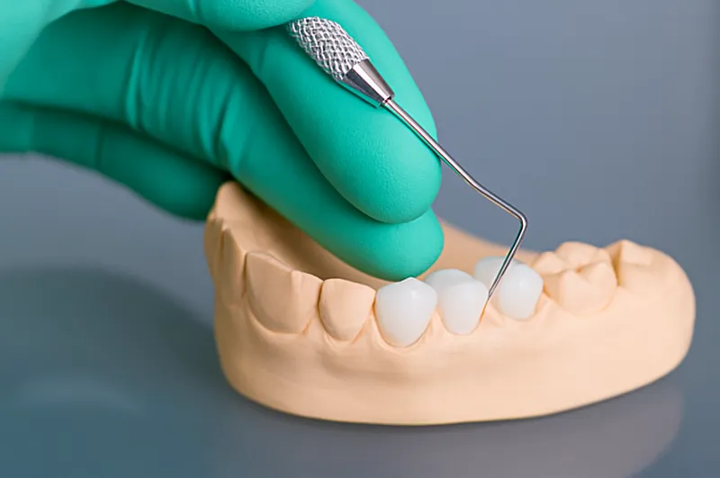 case-image-1